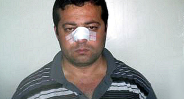 Корреспондент азербайджанской службы "Радио Свобода" Эльчин Исмаил, подвергшийся нападению во время работы в селе Буйнуз 26 мая 2014 г. Фото: Радио Азадлыг (RFE/RL), www.radioazadlyg.org