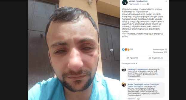 Избитый Вардан Арутюнян. Скриншот его публикации в соцсетях от 3 июня, https://www.facebook.com/photo.php?fbid=2453172568055999&set=a.618587571514517&type=3&theater