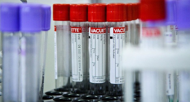 Лабораторные анализы. Фото Елены Синеок, Юга.ру
