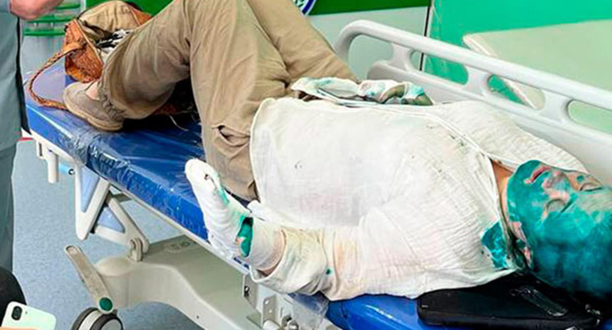 Елена Милашина после нападения. Фото: Телеграм-Канал no_torture

