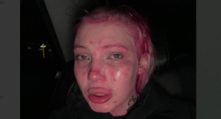 Юлия Максимовская после нападения. Скриншот фото из ее Telegram-канала от 9.12.23, https://t.me/finessthebest/2796