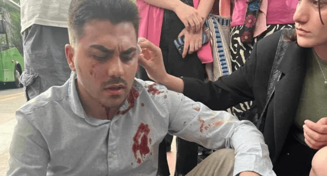 Нико Манагадзе после нападения. Скриншот фото "Интерпрессньюс" от 07.06.24, https://www.interpressnews.ge/ru/article/160822-fizicheski-raspravilis-s-liderom-studencheskogo-dvizheniia-za-svobodu-niko-managadze
