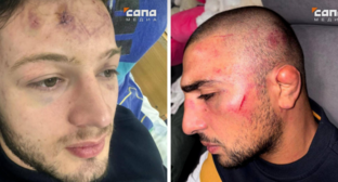 Избитые в Цхинвале молодые люди. Скриншот фото "Сапа Цхинвал" от 20.10.25, https://t.me/sapa_tskhinval/3019